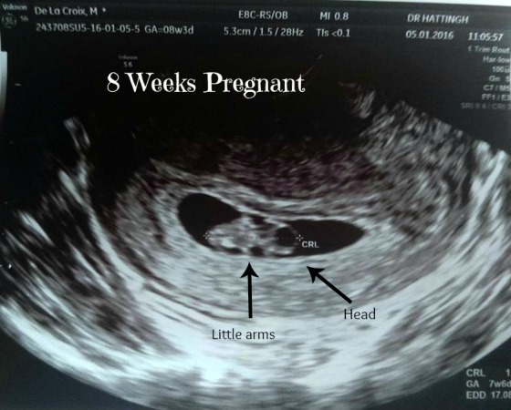 8 Weeks pregnant scan.jpg